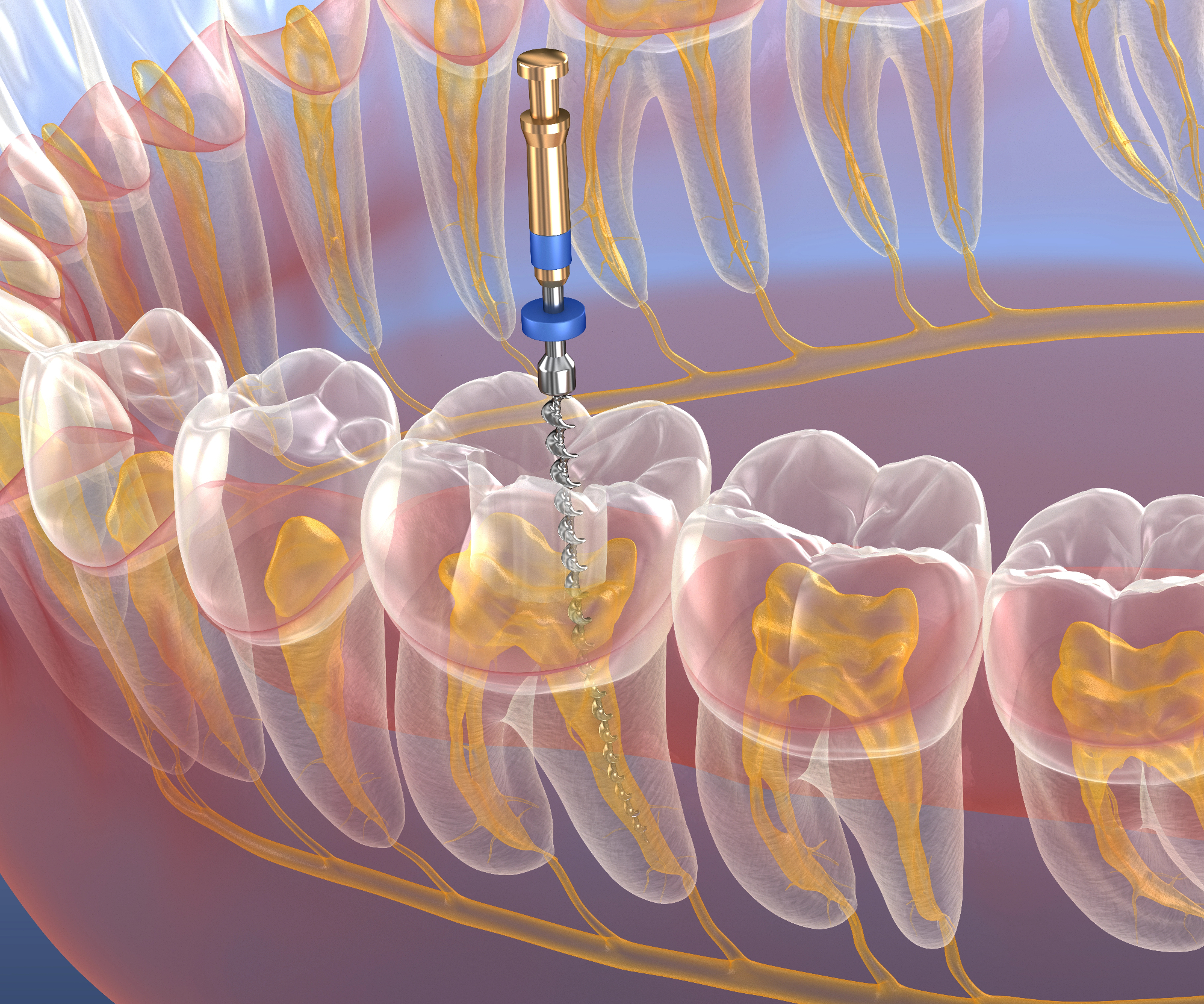 Endodontija mi je rešila zob